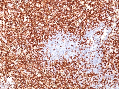 Formalin-fixed, paraffin-embedded human Tonsil stained with  CD45RO Monoclonal Antibody (UCHL-1 + T2/797).