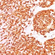 Formalin-fixed, paraffin-embedded human Tonsil stained with CD45 Monoclonal Antibody (PTPRC/146).
