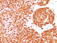 Formalin-fixed, paraffin-embedded human Tonsil stained with CD45 Monoclonal Antibody (PTPRC/146).