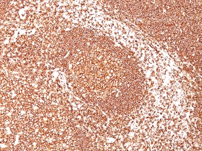 Formalin-fixed, paraffin-embedded human Tonsil stained with CD45 Monoclonal Antibody (PTPRC/1461).