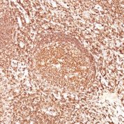 Formalin-fixed, paraffin-embedded human Tonsil stained with CD45 Monoclonal Antibody (F1-89-4).