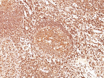 Formalin-fixed, paraffin-embedded human Tonsil stained with CD45 Monoclonal Antibody (F1-89-4).