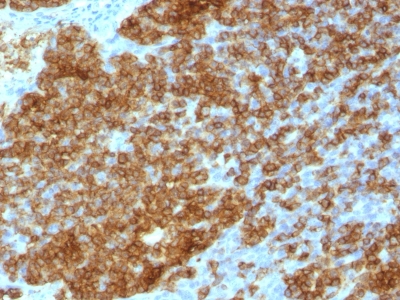 Formalin-fixed, paraffin-embedded human Tonsil stained with CD45RA Monoclonal Antibody (SPM568).