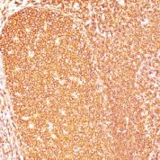 Formalin-fixed, paraffin-embedded human Tonsil stained with CD45RB Ab (PD7/26).
