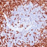 Formalin-fixed, paraffin-embedded human Tonsil stained with CD45RO Monoclonal Antibody (T2/797).