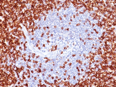 Formalin-fixed, paraffin-embedded human Tonsil stained with CD45RO Monoclonal Antibody (T2/797).