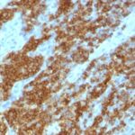 Formalin-fixed, paraffin-embedded human Tonsil stained with CD45RA Monoclonal Antibody (111-1C5).