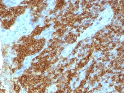 Formalin-fixed, paraffin-embedded human Tonsil stained with CD45RA Monoclonal Antibody (111-1C5).