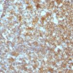 Formalin-fixed, paraffin-embedded human Tonsil stained with CD45RA Monoclonal Antibody (SPM54).