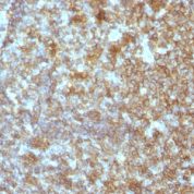 Formalin-fixed, paraffin-embedded human Tonsil stained with CD45RA Monoclonal Antibody (SPM54).