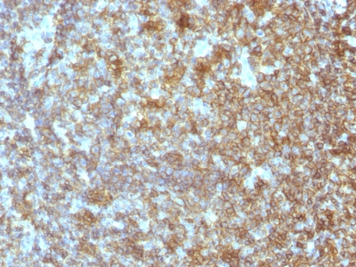 Formalin-fixed, paraffin-embedded human Tonsil stained with CD45RA Monoclonal Antibody (SPM54).