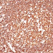 Formalin-fixed, paraffin-embedded human Tonsil stained with CD45 Monoclonal Antibody (135-4C5).