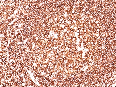 Formalin-fixed, paraffin-embedded human Tonsil stained with CD45 Monoclonal Antibody (135-4C5).