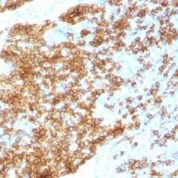 Formalin-fixed paraffin-embedded human Tonsil stained with CD45RB Recombinant Rabbit Monoclonal Antibody (PTPRC/1783R).