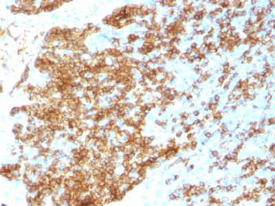 Formalin-fixed paraffin-embedded human Tonsil stained with CD45RB Recombinant Rabbit Monoclonal Antibody (PTPRC/1783R).