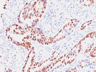 Formalin-fixed, paraffin-embedded human Colon stained with Retinoblastoma (Rb1) Monoclonal Antibody (SPM353).