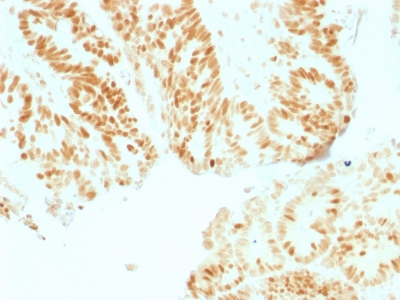 Formalin-fixed, paraffin-embedded human Colon stained with Retinoblastoma (Rb1) Monoclonal Antibody (RB1/1754).
