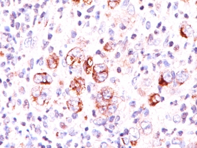 Western Blot of Jurkat Cell Lysate using Bcl-x Monoclonal Antibody (2H12).