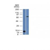 Western Blot Analysis (A) Recombinant Protein (B) HepG2 Cell lysateUsing bcl-6 Monoclonal Antibody (BCL6/1475).