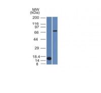 Western Blot Analysis (A) Recombinant Protein (B) HepG2 Cell lysateUsing bcl-6 Monoclonal Antibody (BCL6/1475).