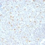 Formalin-fixed, paraffin-embedded human Tonsil stained with bcl-6 Monoclonal Antibody (BCL6/1526).