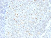 Formalin-fixed, paraffin-embedded human Tonsil stained with bcl-6 Monoclonal Antibody (BCL6/1526).