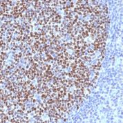 Formalin-fixed, paraffin-embedded human Tonsil stained with bcl-6 Monoclonal Antibody (BCL6/1527).