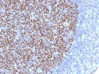 Formalin-fixed, paraffin-embedded human Tonsil stained with bcl-6 Monoclonal Antibody (BCL6/1527).