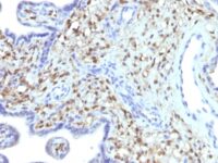 Western Blot of HeLa, A549 and A375 Cell Lysate using S1A4 Monoclonal Antibody (S1A4/1481).