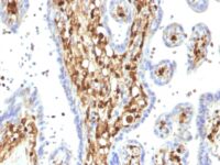 Western Blot of HeLa, A549 and A375 Cell Lysate using S1A4 Monoclonal Antibody (S1A4/1482).