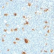 Formalin-fixed, paraffin-embedded human Tonsil stained with Calgranulin B Monoclonal Antibody (CAGB/426)