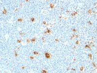 Formalin-fixed, paraffin-embedded human Tonsil stained with Calgranulin B Monoclonal Antibody (CAGB/426)