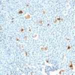 Formalin-fixed, paraffin-embedded human Tonsil stained with Calprotectin Monoclonal Antibody (CPT/128)