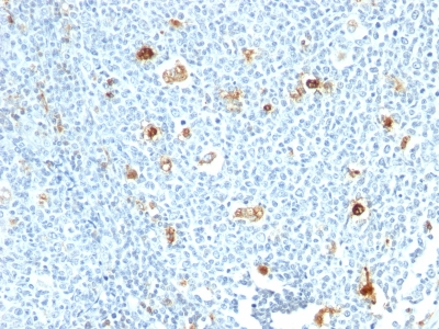 Formalin-fixed, paraffin-embedded human Tonsil stained with Calprotectin Monoclonal Antibody (CPT/128)