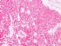 Western blot analysis of human brain lysate using S1B Mouse Monoclonal Antibody (4C4.9).