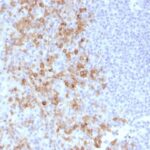 Formalin-fixed, paraffin-embedded human Tonsil stained withCD162 Monoclonal Antibody (PSGL1/161).