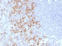 Formalin-fixed, paraffin-embedded human Tonsil stained withCD162 Monoclonal Antibody (PSGL1/161).