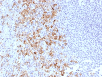 Formalin-fixed, paraffin-embedded human Tonsil stained withCD162 Monoclonal Antibody (PSGL1/161).
