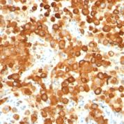 Formalin-fixed, paraffin-embedded human Testis stained with gp1 / Melanosome Monoclonal Antibody (HMB45 + PMEL/783).