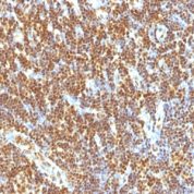 Formalin-fixed, paraffin-embedded human Tonsil stained with SUMO-2 Monoclonal Antibody (SUMO2/1199)