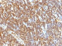 Formalin-fixed, paraffin-embedded human Tonsil stained with SUMO-2 Monoclonal Antibody (SUMO2/1199)