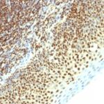 Formalin-fixed, paraffin-embedded human Tonsil stained with SUMO-2 Monoclonal Antibody (SPM621)