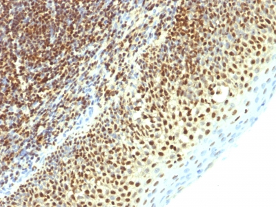 Formalin-fixed, paraffin-embedded human Tonsil stained with SUMO-2 Monoclonal Antibody (SPM621)