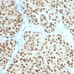 Western blot analysis of SOX1 (A) Recombinant protein (B) A375 Cell lysate using SOX1 MAb (SOX1/991).