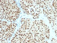 Western blot analysis of SOX1 (A) Recombinant protein (B) A375 Cell lysate using SOX1 MAb (SOX1/991).