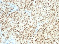 Western blot analysis of SOX1 (A) Recombinant protein; (B) A375 Cell lysate using SOX1 MAb (SOX1/174).