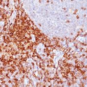 Formalin-fixed, paraffin-embedded human Spleen stained with CD43 Monoclonal Antibody (Bra7G).