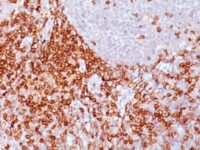 Formalin-fixed, paraffin-embedded human Spleen stained with CD43 Monoclonal Antibody (Bra7G).