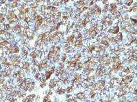 Formalin-fixed, paraffin-embedded Rat Pancreas stained with Spectrin beta III Monoclonal Antibody (SPTBN2/1247).