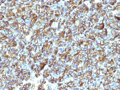 Formalin-fixed, paraffin-embedded Rat Pancreas stained with Spectrin beta III Monoclonal Antibody (SPTBN2/1247).